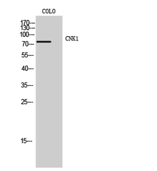 CNK1 rabbit pAb Antibody