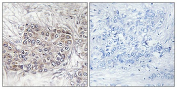 CNK1 rabbit pAb Antibody