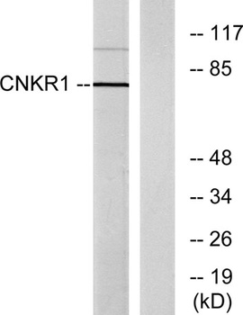 CNK1 rabbit pAb Antibody