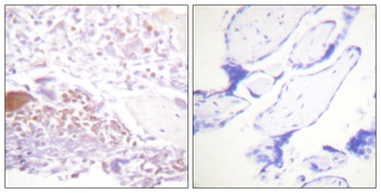 p57 (phospho Thr310) rabbit pAb