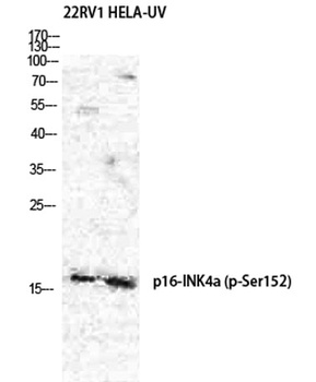 p16-INK4a (Phospho-Ser152) rabbit pAb