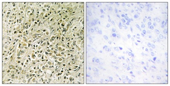 DLC-1 rabbit pAb Antibody