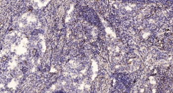 Mindin rabbit pAb Antibody