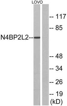 PFAAP5 rabbit pAb Antibody