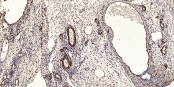 PFAAP5 rabbit pAb Antibody