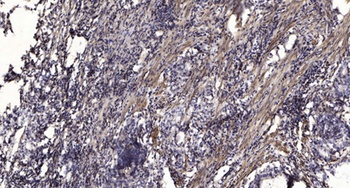 RNF15 rabbit pAb Antibody