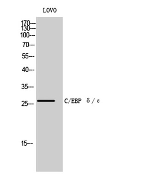 C/EBP δ/ε rabbit pAb Antibody