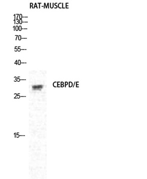 C/EBP δ/ε rabbit pAb Antibody