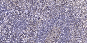 C/EBP δ/ε rabbit pAb Antibody