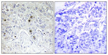 B-ATF rabbit pAb Antibody