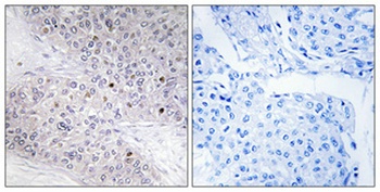 C/EBP γ rabbit pAb Antibody