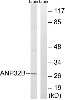 PHAPI2 rabbit pAb Antibody