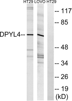 CRMP-3 rabbit pAb Antibody
