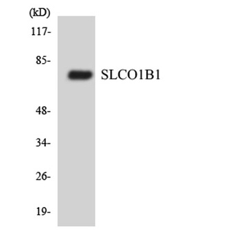 OATP-C rabbit pAb Antibody