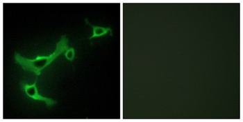 TRIM3 rabbit pAb Antibody
