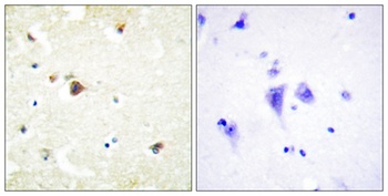 TRIM3 rabbit pAb Antibody