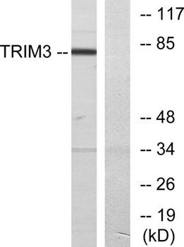 TRIM3 rabbit pAb Antibody