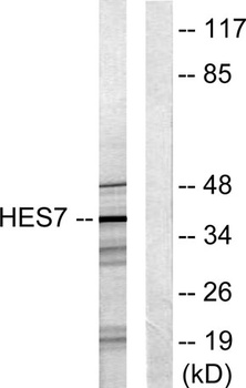 Hexim1 rabbit pAb Antibody
