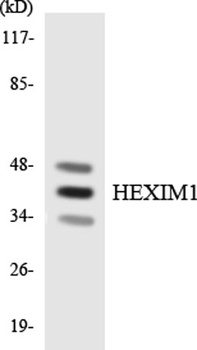 Hexim1 rabbit pAb Antibody