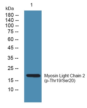 MLC-2 (phospho Thr17/S18) rabbit pAb