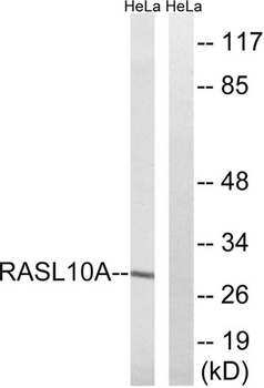 RRP22 rabbit pAb Antibody