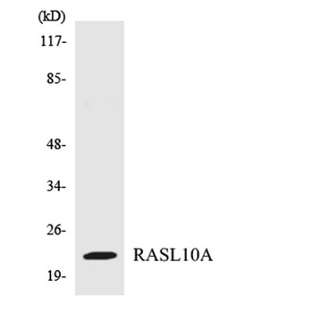 RRP22 rabbit pAb Antibody