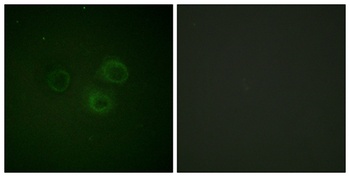 DNAM-1 (phospho Ser329) rabbit pAb