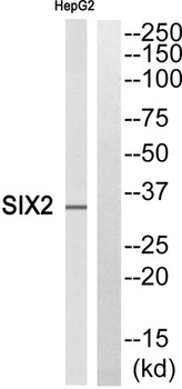 Six2 rabbit pAb Antibody