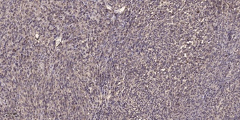 Six2 rabbit pAb Antibody