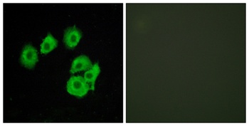 CysLTR1 rabbit pAb Antibody