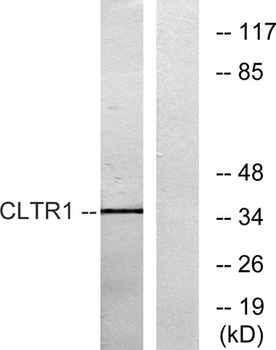 CysLTR1 rabbit pAb Antibody