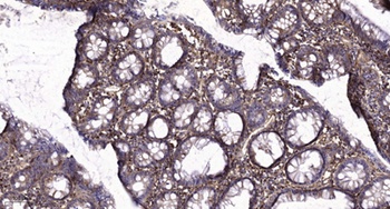 CysLTR1 rabbit pAb Antibody
