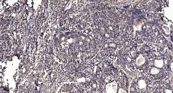 StARD10 rabbit pAb Antibody