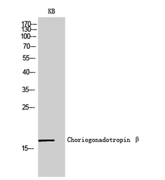 Choriogonadotropin β rabbit pAb Antibody