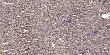 PDE10A rabbit pAb Antibody