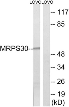 MRP-S30 rabbit pAb Antibody