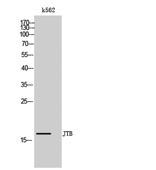 JTB rabbit pAb Antibody