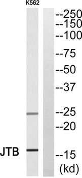 JTB rabbit pAb Antibody