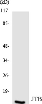 JTB rabbit pAb Antibody