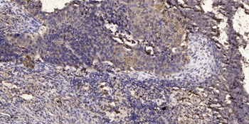 JTB rabbit pAb Antibody