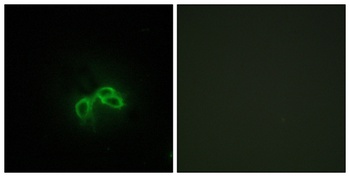 Bc10 rabbit pAb Antibody