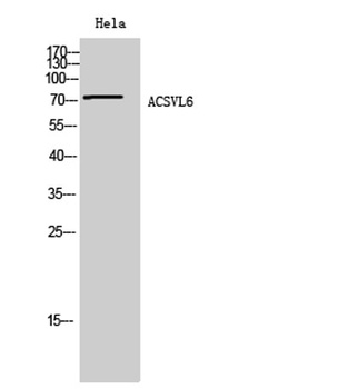 ACSVL6 rabbit pAb Antibody
