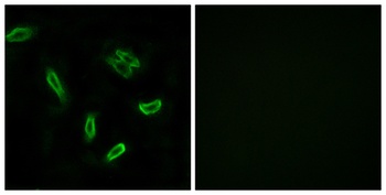 ACSVL6 rabbit pAb Antibody