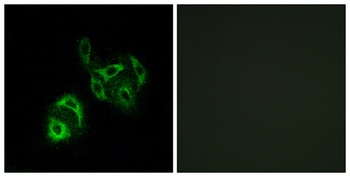 ACSVL4 rabbit pAb Antibody