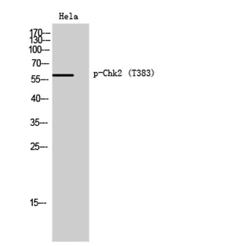 Chk2 (phospho Thr383) rabbit pAb Antibody