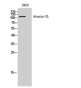 Ataxin-2L rabbit pAb Antibody