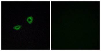 mAChR M5 rabbit pAb Antibody