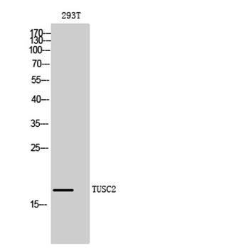 TUSC2 rabbit pAb Antibody