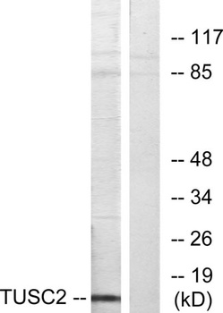 TUSC2 rabbit pAb Antibody