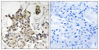 HP1γ rabbit pAb Antibody